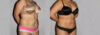Liposuction case #5828 slider thumbnail