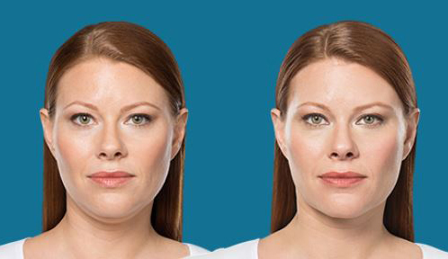 Procedure case #5591