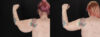 Arm Lift case #256569 slider thumbnail