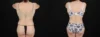 Tummy Tuck case #263466 slider thumbnail